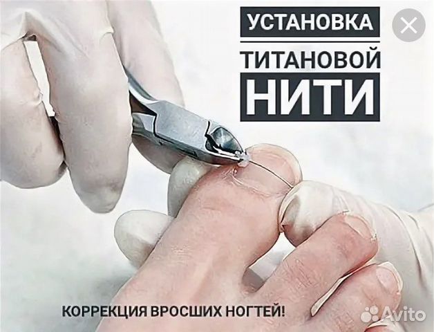 Титановая нить для ногтей фото